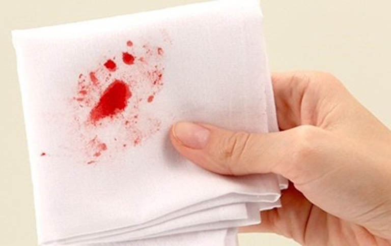 Tình trạng chảy máu búi trĩ nếu để kéo dài có thể gây thiếu máu nghiêm trọng